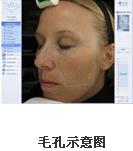VISIA沿Dxa(chn)ƷB