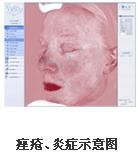 VISIA沿Dxa(chn)ƷB