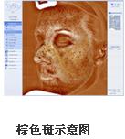 VISIA沿Dxa(chn)ƷB