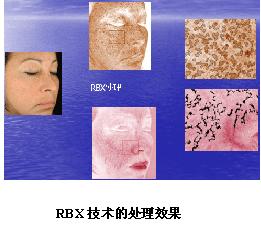 VISIA沿Dxa(chn)ƷB